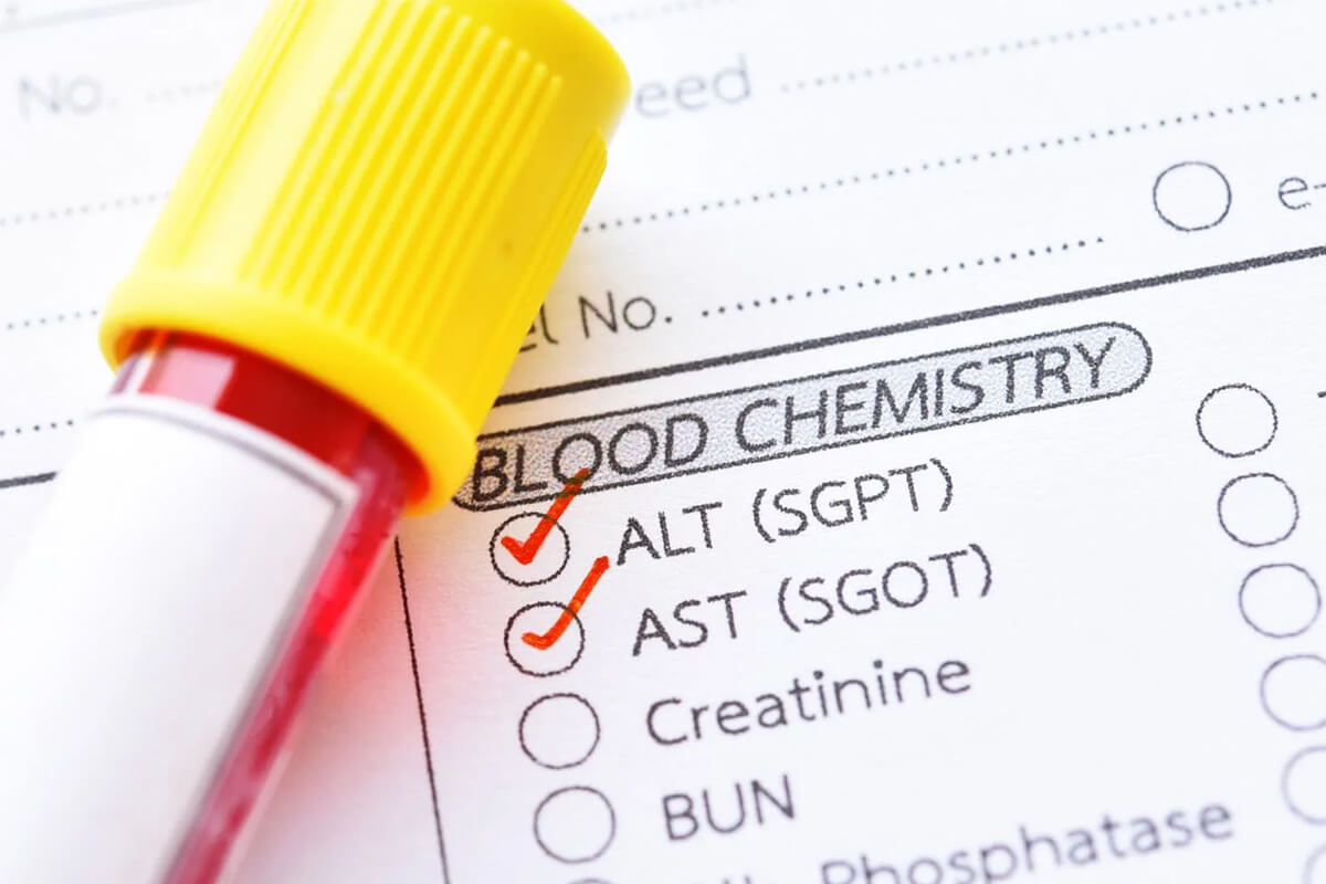 Показатели ALT, AST в биохимическом анализе крови