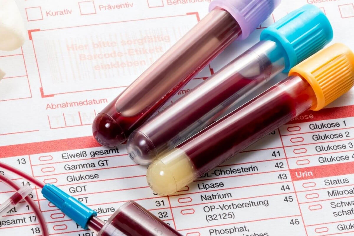 Расшифровка биохимического анализа крови